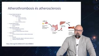 23 Atherothromosis és atherosclerosis