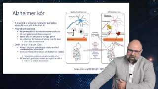 34 Alzheimer kór