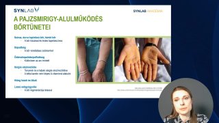 A pajzmirigy alulműködés bőrtünetei