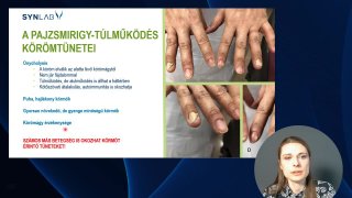 A pajzsirigy túlműködés körömtünetei