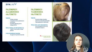 Pajzsmirigy alul-felülműködés hajtünetei