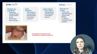 Nyakon látható elváltozás_2