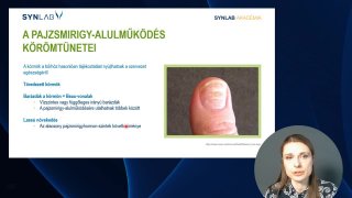 A pajzsmirigy alulműködés körömtünetei