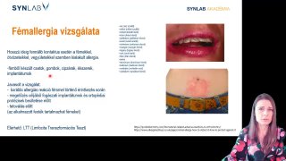 18 - Fémallergia vizsgálat